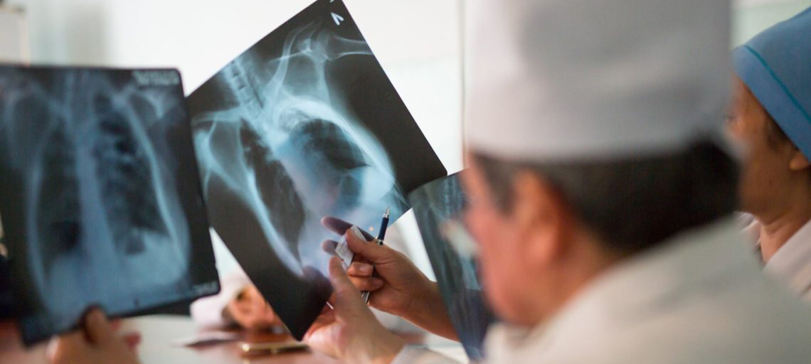 Число умерших от пневмонии в Карелии за 1,5 месяца выросло до 41 