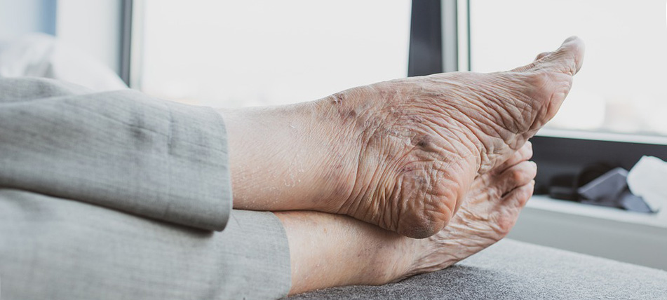 В Карелии одиноким старикам бесплатно подстригли ногти на ногах