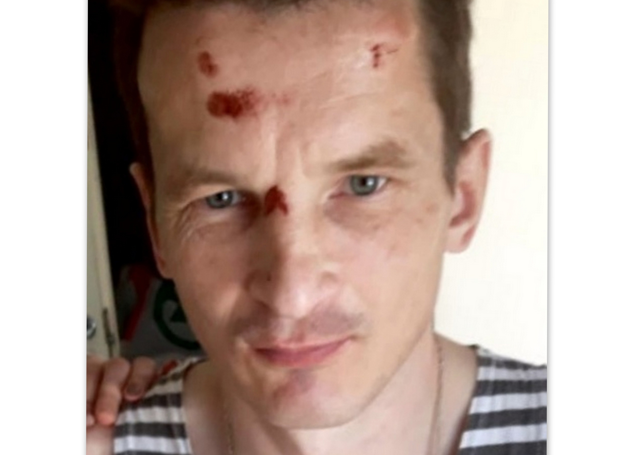 Объявлен в розыск мужчина, который ушел из инфекционной больницы в Петрозаводске и пропал