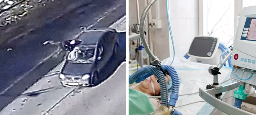 В Минздраве рассказали о состоянии пешехода, пострадавшего в ДТП на Ключевой в Петрозаводске 