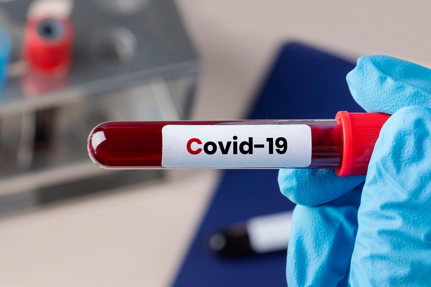 Уровень заболеваемости Covid-19 в Карелии вновь вырос
