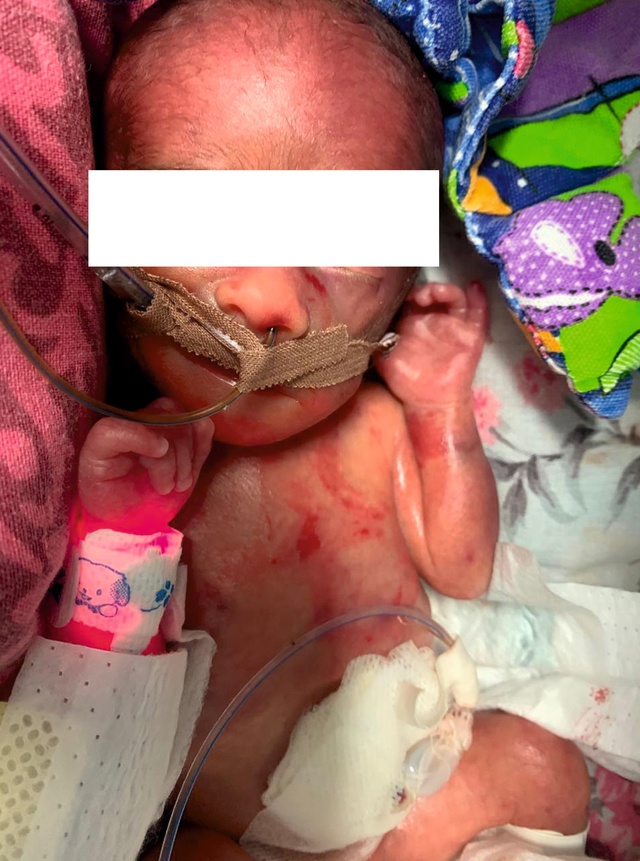 Новорожденный в Карелии выжил благодаря медикам, водителям, пилотам и региональному Минтрансу