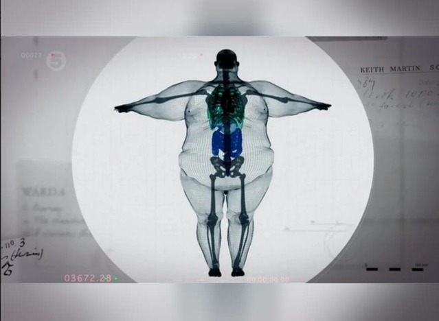 Глава карельского Минздрава предостерег граждан  от похудения с помощью препаратов