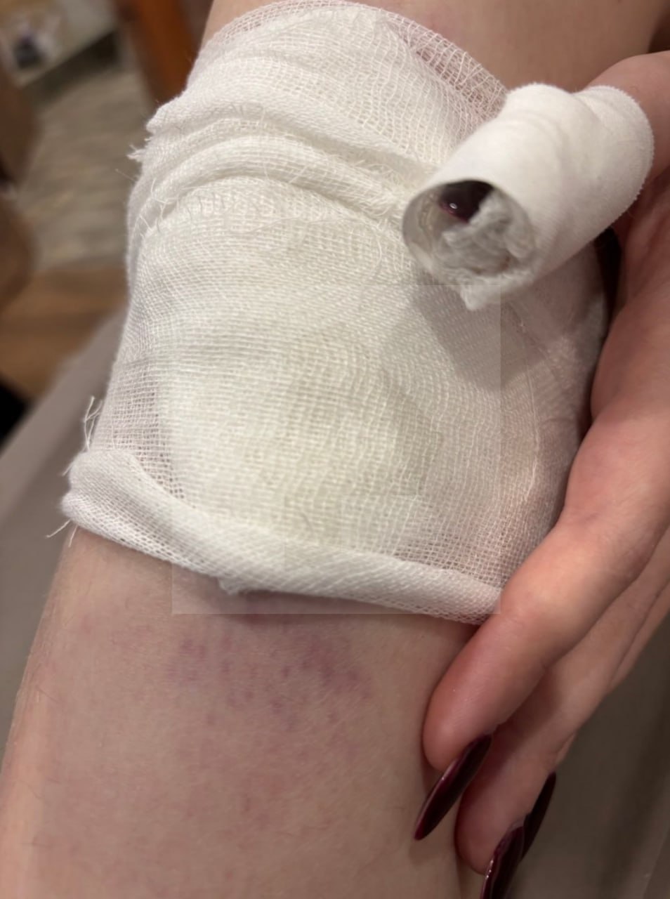 Пассажирка перевернувшегося в Карелии судна на воздушной подушке рассказала о неадекватном водителе