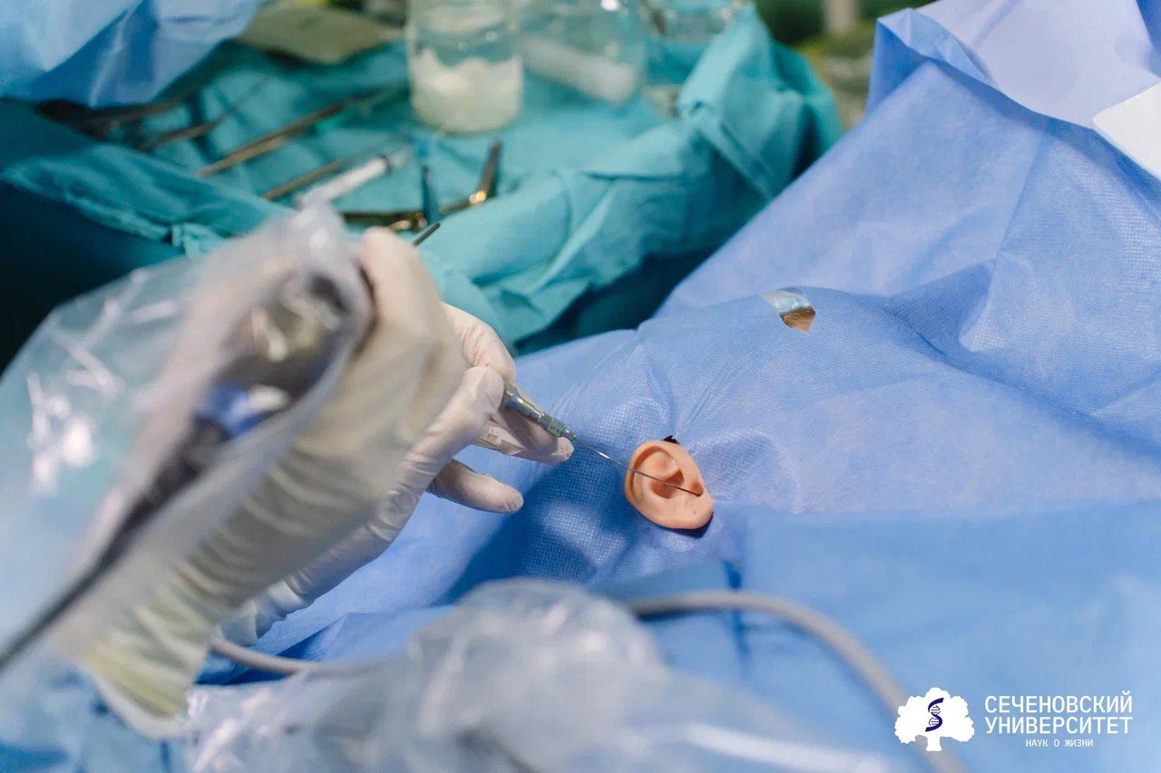 В России впервые в мире начали восстанавливать барабанную перепонку клетками пациента
