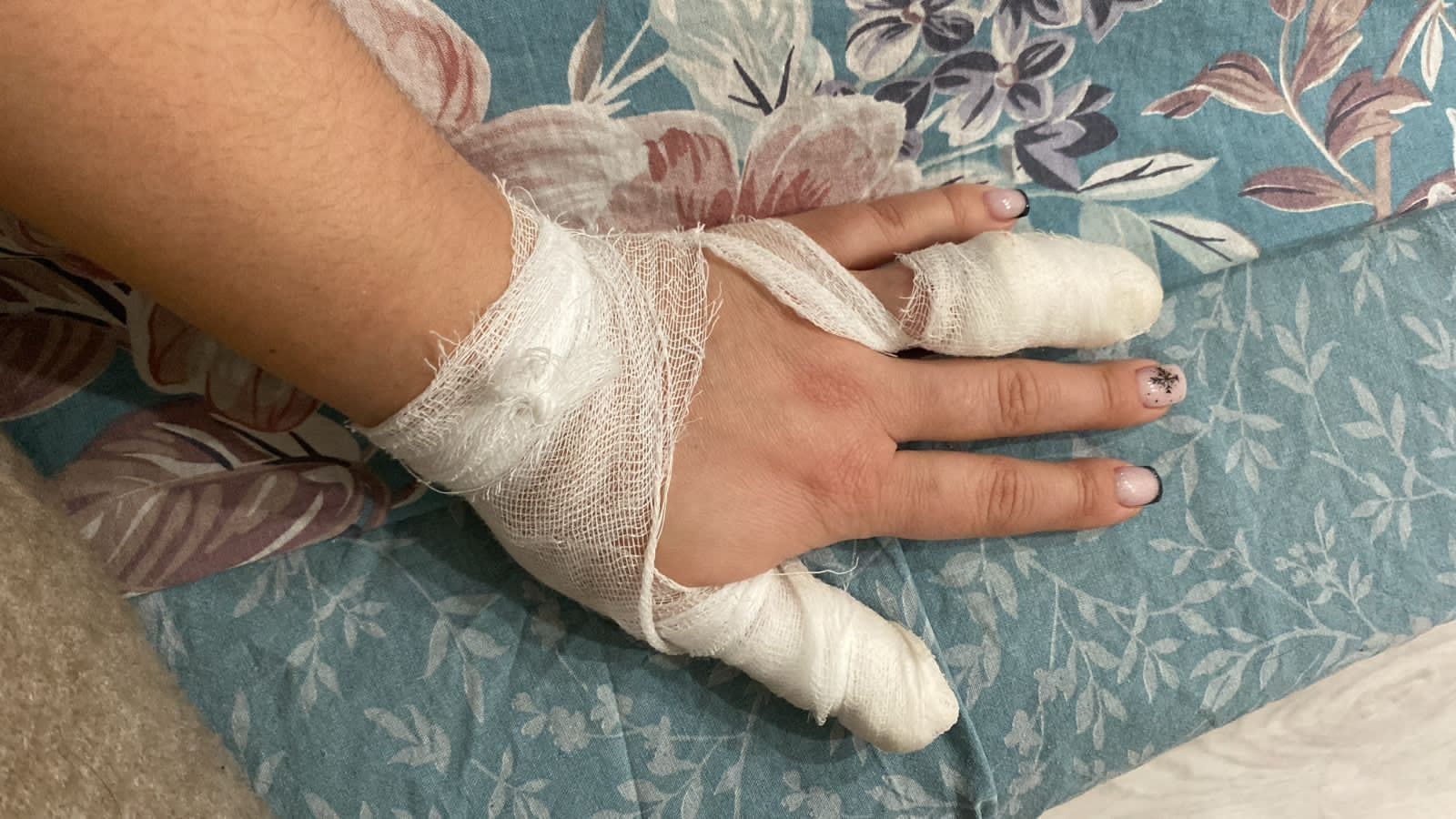 Бультерьер без поводка покусал девушку и ее собаку в Питкяранте