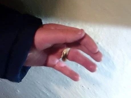 Петрозаводские спасатели оказали помощь застрявшему в металлическом крюке мальчику